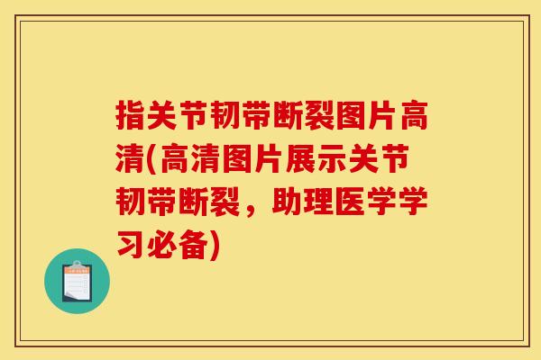 指关节韧带断裂图片高清(高清图片展示关节韧带断裂，助理医学学习必备)