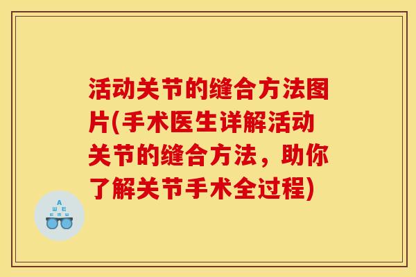 活动关节的缝合方法图片(手术医生详解活动关节的缝合方法，助你了解关节手术全过程)