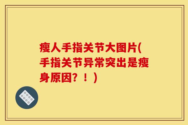 瘦人手指关节大图片(手指关节异常突出是瘦身原因？！)
