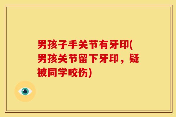 男孩子手关节有牙印(男孩关节留下牙印，疑被同学咬伤)