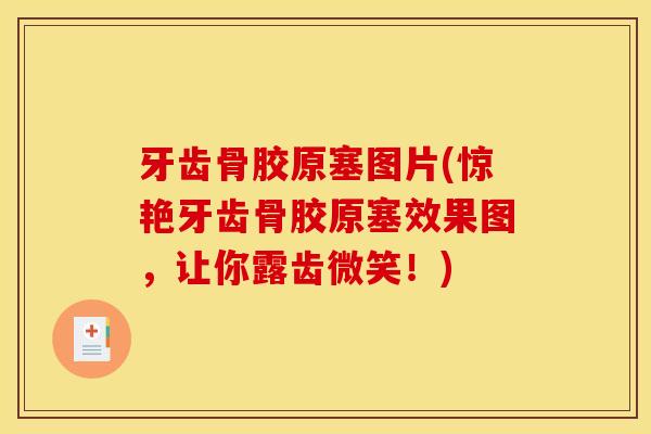 牙齿骨胶原塞图片(惊艳牙齿骨胶原塞效果图，让你露齿微笑！)