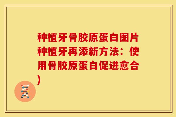 种植牙骨胶原蛋白图片种植牙再添新方法：使用骨胶原蛋白促进愈合)