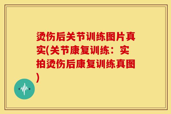 烫伤后关节训练图片真实(关节康复训练：实拍烫伤后康复训练真图)