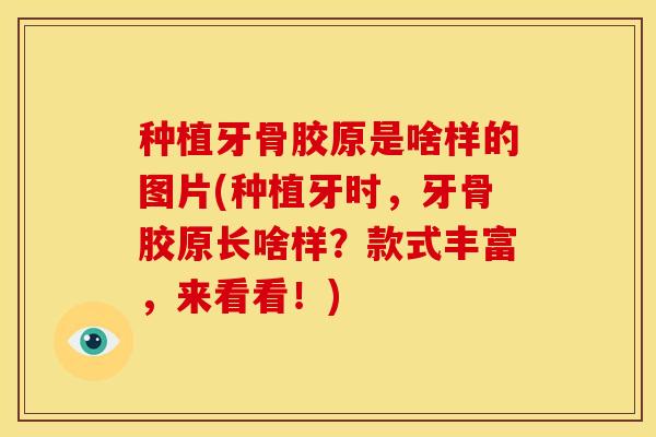 种植牙骨胶原是啥样的图片(种植牙时，牙骨胶原长啥样？款式丰富，来看看！)