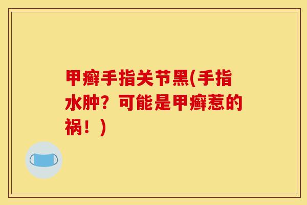 甲癣手指关节黑(手指水肿?可能是甲癣惹的祸!) 甲癣手指关节黑(手指水肿?可能是甲癣惹的祸!)