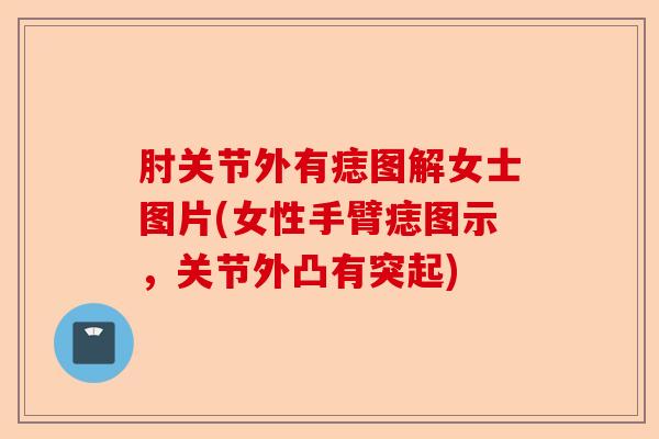 肘关节外有痣图解女士图片(女性手臂痣图示，关节外凸有突起)