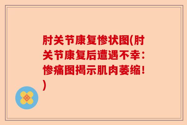 肘关节康复惨状图(肘关节康复后遭遇不幸：惨痛图揭示肌肉萎缩！)