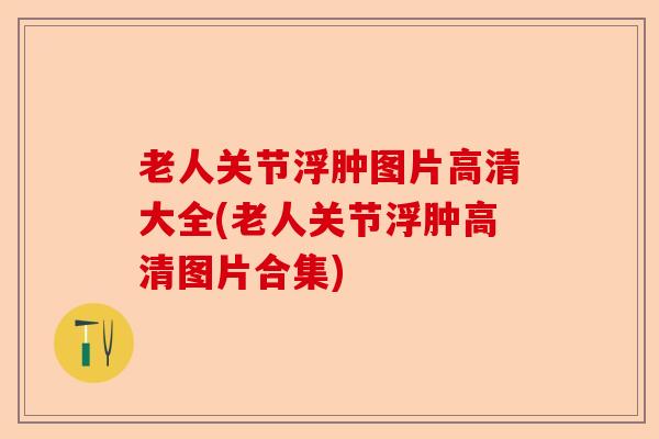 老人关节浮肿图片高清大全(老人关节浮肿高清图片合集)