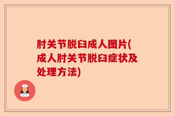 肘关节脱臼成人图片(成人肘关节脱臼症状及处理方法) 肘关节脱臼成人图片(成人肘关节脱臼症状及处理方法)