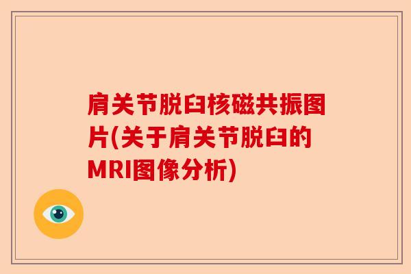 肩关节脱臼核磁共振图片(关于肩关节脱臼的MRI图像分析) 肩关节脱臼核磁共振图片(关于肩关节脱臼的MRI图像分析)