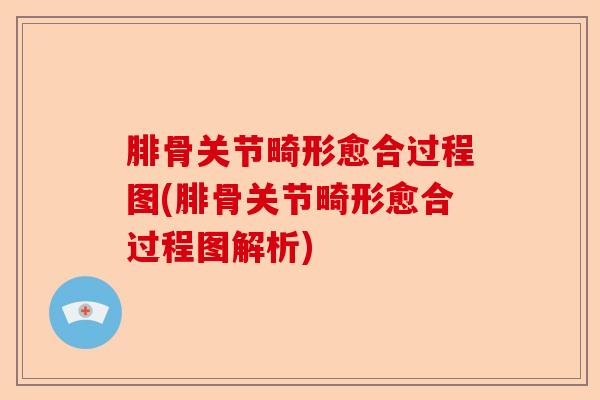 腓骨关节畸形愈合过程图(腓骨关节畸形愈合过程图解析)
