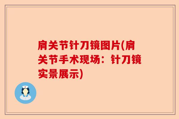 肩关节针刀镜图片(肩关节手术现场：针刀镜实景展示)