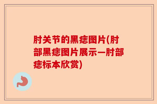 肘关节的黑痣图片(肘部黑痣图片展示—肘部痣标本欣赏)