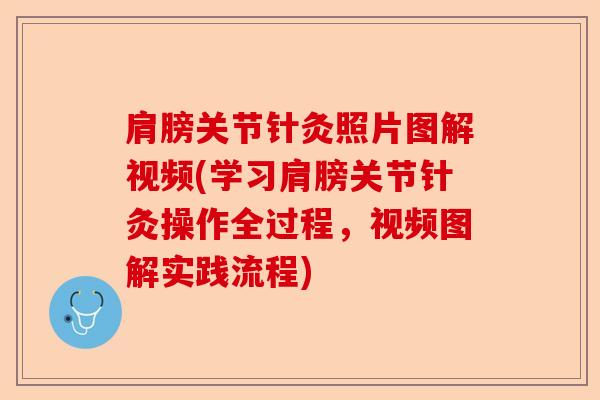 肩膀关节针灸照片图解视频(学习肩膀关节针灸操作全过程，视频图解实践流程)