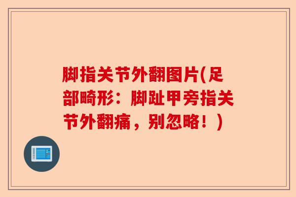 脚指关节外翻图片(足部畸形：脚趾甲旁指关节外翻痛，别忽略！)
