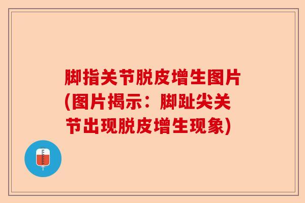 脚指关节脱皮增生图片(图片揭示:脚趾尖关节出现脱皮增生现象) 脚指关节脱皮增生图片(图片揭示:脚趾尖关节出现脱皮增生现象)