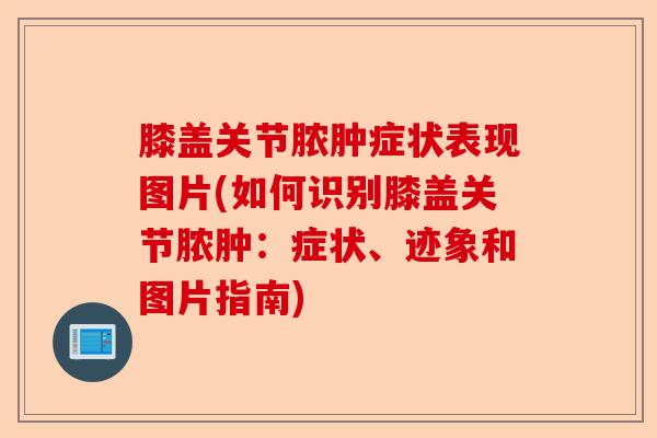 膝盖关节脓肿症状表现图片(如何识别膝盖关节脓肿：症状、迹象和图片指南)