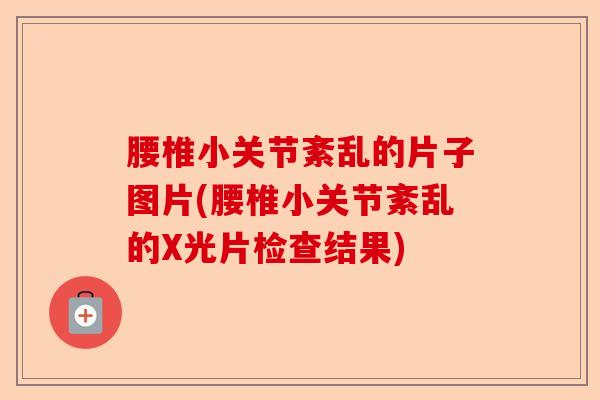 腰椎小关节紊乱的片子图片(腰椎小关节紊乱的X光片检查结果)