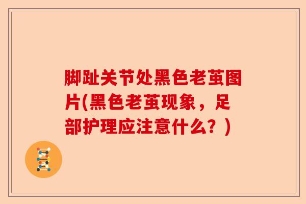 脚趾关节处黑色老茧图片(黑色老茧现象，足部护理应注意什么？)