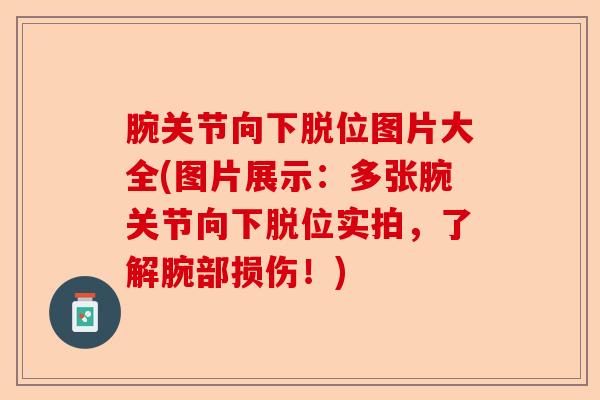 腕关节向下脱位图片大全(图片展示：多张腕关节向下脱位实拍，了解腕部损伤！)