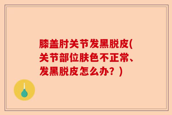 膝盖肘关节发黑脱皮(关节部位肤色不正常、发黑脱皮怎么办？)