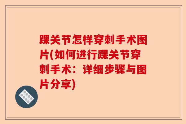 踝关节怎样穿刺手术图片(如何进行踝关节穿刺手术：详细步骤与图片分享)