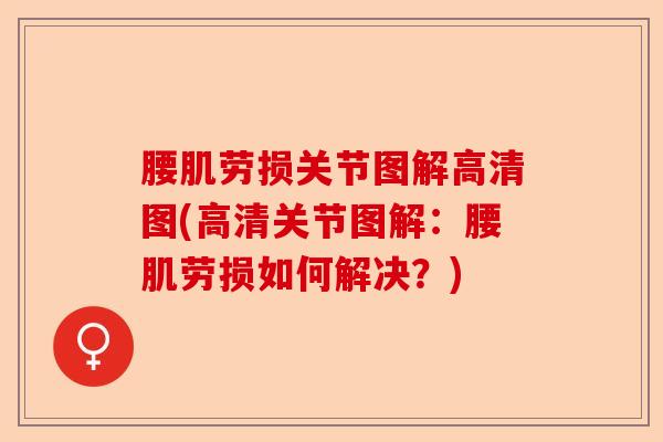 腰肌劳损关节图解高清图(高清关节图解：腰肌劳损如何解决？)