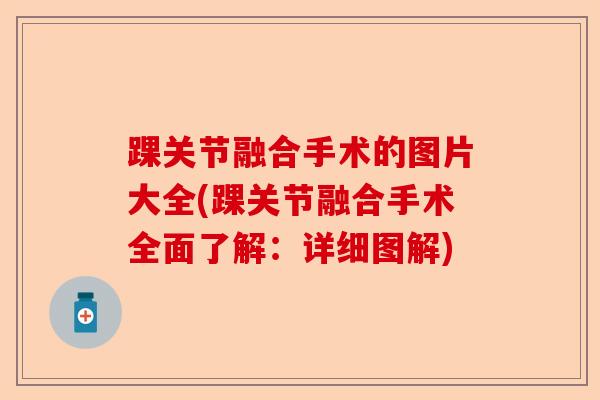 踝关节融合手术的图片大全(踝关节融合手术全面了解:详细图解) 踝关节融合手术的图片大全(踝关节融合手术全面了解:详细图解)