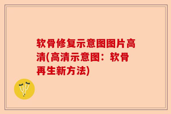 软骨修复示意图图片高清(高清示意图：软骨再生新方法)