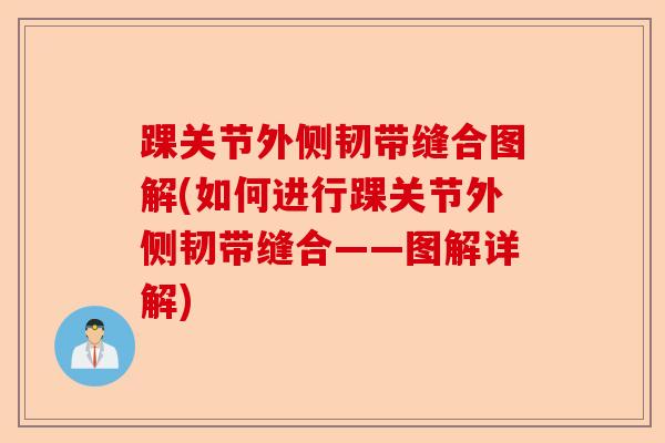 踝关节外侧韧带缝合图解(如何进行踝关节外侧韧带缝合——图解详解) 踝关节外侧韧带缝合图解(如何进行踝关节外侧韧带缝合——图解详解)