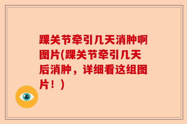 踝关节牵引几天消肿啊图片(踝关节牵引几天后消肿,详细看这组图片!) 踝关节牵引几天消肿啊图片(踝关节牵引几天后消肿,详细看这组图片!)